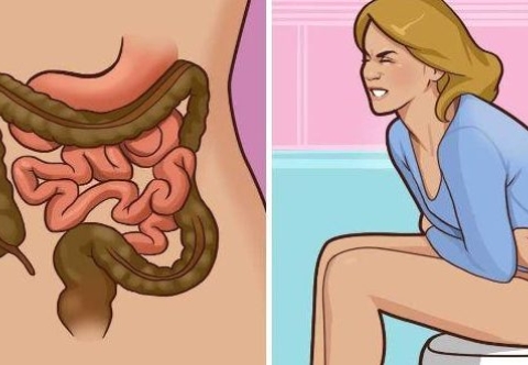 Dấu hiệu phổ biến của ung thư trực tràng 